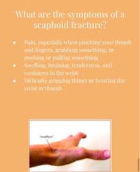 Image result for Scaphoid Fracture Signs