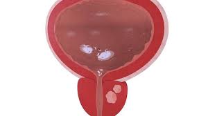 High dose vitamin d3 side effects mayo clinic. á… Anwendung Und Ablauf Der Prostatauntersuchung