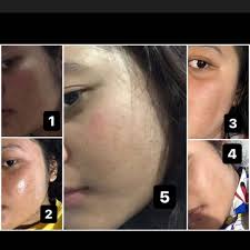 Check spelling or type a new query. Naavagreen Sunscreen Review Female Daily