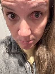 Experiences with the Air Puff Test for Eye Pressure