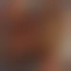 Image result for Intestinal Enteropathy