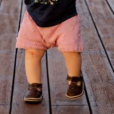 Image result for Pediatric Limp