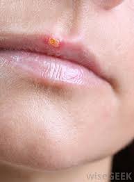 Dog skin infection pictures (top: What Are Some Types Of Skin Infections With Pictures