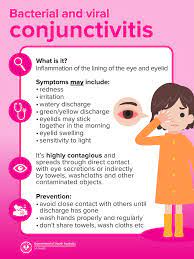 Sa Health - 👁 Conjunctivitis Is A Common Eye Infection And Can Be Caused  By Bacteria, Viruses Or Allergies. Bacterial And Viral Infections Can Be  Highly Contagious, So Make Sure You Take