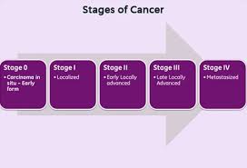 The term malignant neoplasm means that a tumor is cancerous. Understanding Cancer Metastasis Stages Of Cancer And More