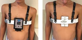 Jecur,oris n lac,lactis n lien,lienis m os,oris n os,ossis n pectus,oris n ren,renis m vas,vasis n viscus,eris n. Pectus Carinatum