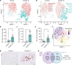 8 ways in which technology helps pandemic management. Dysregulation Of Brain And Choroid Plexus Cell Types In Severe Covid 19 Nature