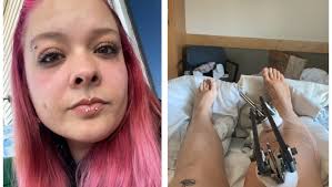 Fundraiser by Ally Bonville : Helping Hand for Unexpected Injury Bills