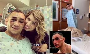 As we've previously reported, tony's wife, cristina, called police to their santa ana, california home. Tony Ferguson Shows Off War Wounds In Hospital Selfie After Suffering A Broken Eye Socket Daily Mail Online