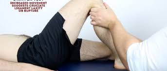 Image result for Knee Bulge Sign