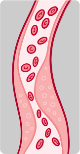 Does cholesterol predict heart disease risk? Control Your Cholesterol Nih News In Health