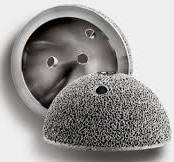 Celebrating ten years of metal additively manufactured hip cups