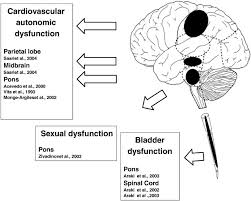 Image result for Autonomic Dysfunction