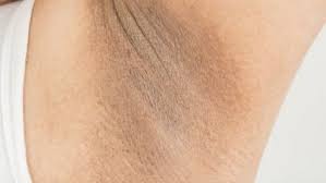 Dal Gibi Zayiflatan Zeytin Yapragi Cayi Nedir Faydalari Neler Zeytin Yapragi Tozu 2020 Koltuk Alti Ev Yapimi Cilt Bakimi Dogal Cilt Bakimi