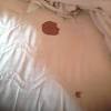 Blot out the stain with a clean, dry cloth. 1