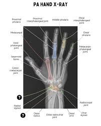 Image result for Wrist XRay