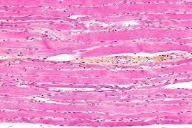 Image result for Muscle Tissue