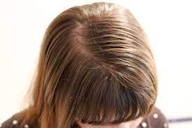 Haircut phobias hair diseases hair loss hair loss q&a hair growth q&a head lice human fleas oily causes and solutions for oily hair. Hair Care Tips For Fine Thin Oily Hair