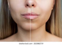 281,079 Agrandar Images, Stock Photos, 3D objects, & Vectors