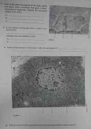 Rather it is a collection of ex­perimental methods of growing large number of isolated cells or tissues under sterile and con­trolled conditions. 7 Look At The Photomicrograph To The Right Which Chegg Com