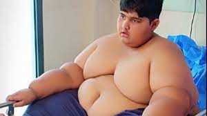 Insa, pe masura ce lunile au trecut el a inceput sa dezvolte o pofta de mancare foarte mare. Cel Mai Gras Copil Din Lume SuferÄƒ De Obezitate MorbidÄƒ Ce Il Poate Salva Foto Publika Md Aici Sunt È™tirile