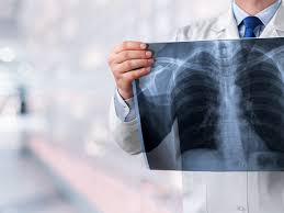 Michigan mesothelioma lawyers are hard at work fighting for the people who have been exposed to asbestos and this article has been fact checked by an experienced mesothelioma attorney. Michigan Asbestos Or Mesothelioma Lawyer The Sam Bernstein Law Firm