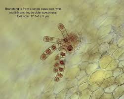 Image result for Acritochaete