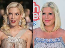 On the beverly hills, 90210 reboot, tori spelling is struggling to make ends meet, but what is a look at 'bh90210' star tori spelling's finances. Mal Dick Mal Dunn Stars Und Ihre Gewichts Achterbahn
