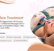 Exo-Glow Treatment – Advanced Skin Rejuvenation with Exosomes