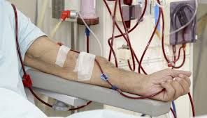 Hemodialysis Market Size Trends Shares Insights And Forecast 2026 Kidney Dialysis Dialysis Machine Dialysis