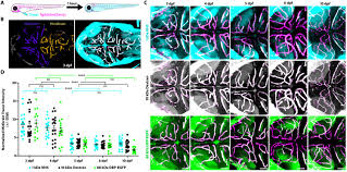 The beauty of primary care with k health. Suppression Of Transcytosis Regulates Zebrafish Blood Brain Barrier Function Elife
