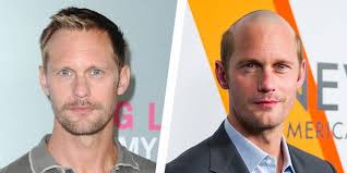 The Biggest Celebrity Hair Transformations for a Role