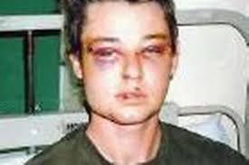 21 fractures for victim of rugby star