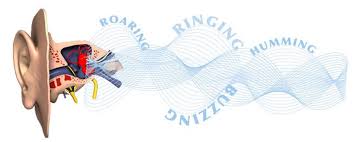 Image result for Tinnitus