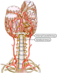 Clearing clogged arteries in the neck march 25, 2020 balloon angioplasty appears to be just as good as surgery to unblock carotid arteries. Vertebral And Internal Carotid Arteries Reprinted With Permission By Download Scientific Diagram
