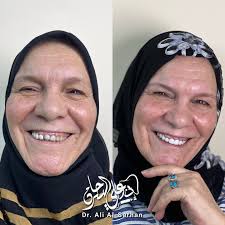 د.علي السرحان Dr.Ali Al Sarhan‎ (@dr.ali.alsarhan) • Instagram photos and  videos