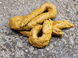 Image result for yellow stool human poop