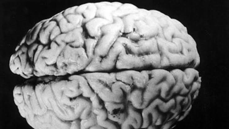 Estudio plantea que el cerebro humano tendría dos orígenes