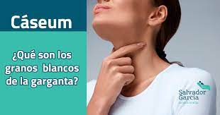 Caseum Que Son Los Granos Blancos En La Garganta