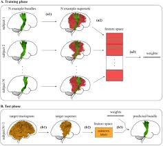 Q.health planning, budgeting and forecasting solution designed for nhs trusts. Classifyber A Robust Streamline Based Linear Classifier For White Matter Bundle Segmentation Biorxiv