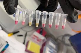 İşte, video ile adım adım izlemeniz gerekenler; Yeni Koronavirus Testi 30 Dakikada Sonucu Veriyor Gunde 1 Milyondan Fazla Test Yapilabilecek Independent Turkce