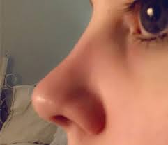 Disney pixar movies have definitely messed up my perception of what a woman's nose should look like. Would Love Rhinoplasty But Everyone Says My Nose Is Perfect And Surgery Would Ruin It Noses