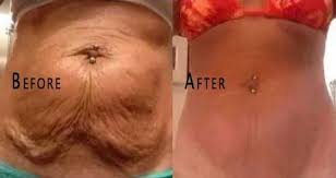 Pin On Health And Beauty