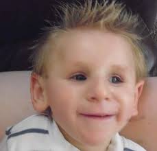 Amy and Friends Cockayne Syndrome and Trichothiodystrophy Support