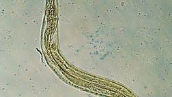 Image result for Pinworm