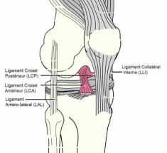 Your healthcare provider will ask about your symptoms and what you were doing at the time of your injury. Reparation Ou Reconstruction Du Ligament Croise Anterieur Du Genou Sous Arthroscopie
