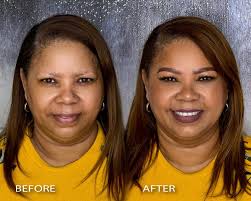 IRIS Richardson Brows