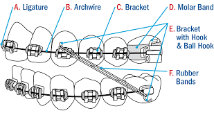 Life During Orthodontic Treatment Your Guide To Orthodontics