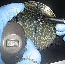 Divide the cfu from the dilution (179) by the result from step 1 (0.005) to yield 35,800 cfu. Colony Forming Unit Wikipedia