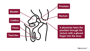 Pain or burning during urination. How To Check For Prostate Cancer At Home Imaware